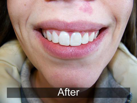 Smiles by Farr | Pediatric Dentistry, All-on-4 reg  and E4D