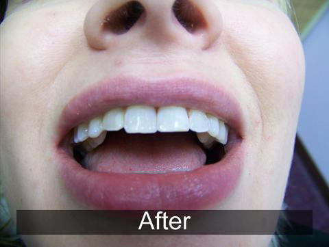 Smiles by Farr | Teeth Whitening, Sleep Apnea and Cosmetic Dentistry