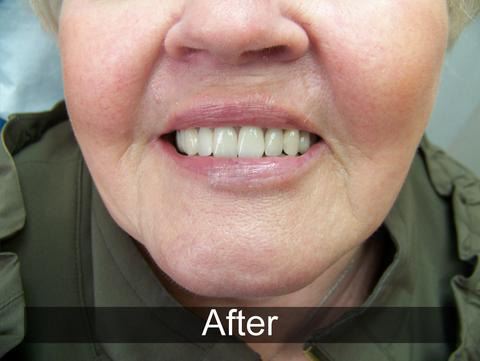 Smiles by Farr | Pediatric Dentistry, Dental Cleanings and Invisalign reg 