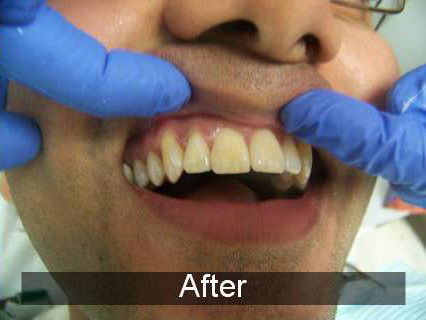 Smiles by Farr | Teeth Whitening, Pediatric Dentistry and Invisalign®