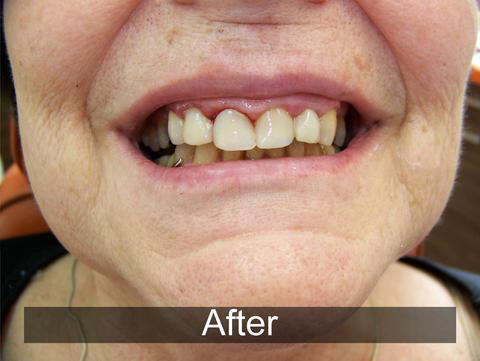 Smiles by Farr | E4D, Sleep Apnea and Cosmetic Dentistry