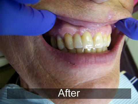 Smiles by Farr | Oral Exams, Laser Dentistry and Cosmetic Dentistry