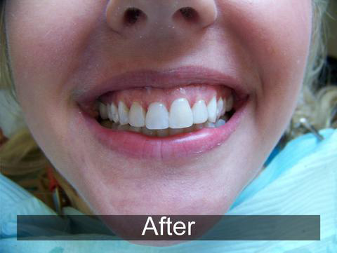 Smiles by Farr | Emergency Treatment, Extractions and Digital Radiography