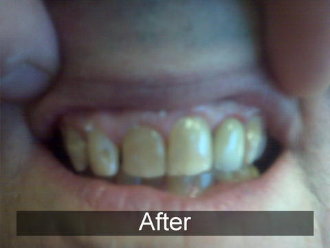 Smiles by Farr | All-on-4®, Botox® and Night Guards