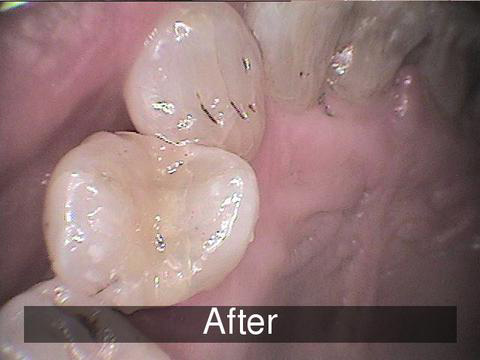 Smiles by Farr | Pediatric Dentistry, TMJ Disorders and Emergency Treatment