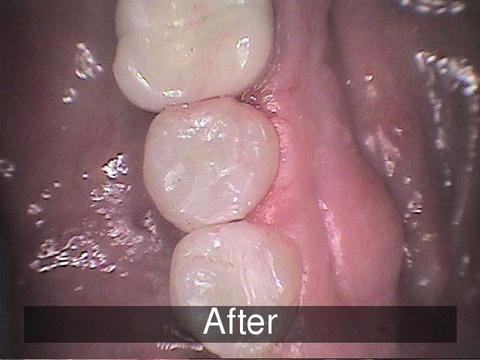 Smiles by Farr | Cosmetic Dentistry, Dental Cleanings and Invisalign®