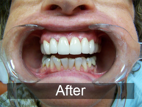 Smiles by Farr | Botox®, Digital Impressions and Digital Scanners