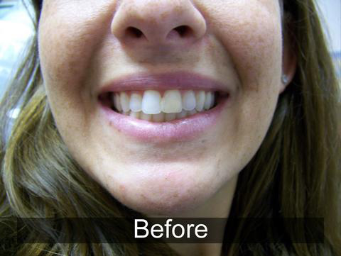 Smiles by Farr | Implant Restorations, CBCT and Botox reg 