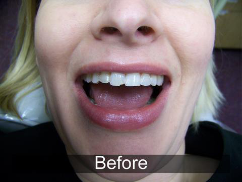 Smiles by Farr | Pediatric Dentistry, Dental Cleanings and Oral Exams