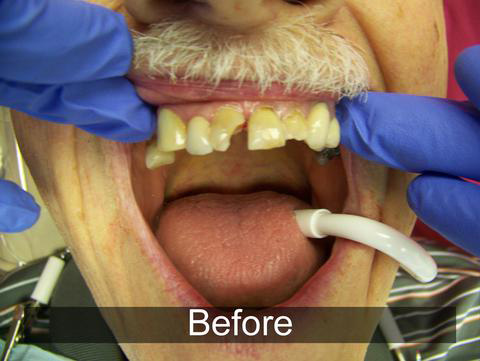 Smiles by Farr | Digital Scanners, Sports Mouthguards and Dentures