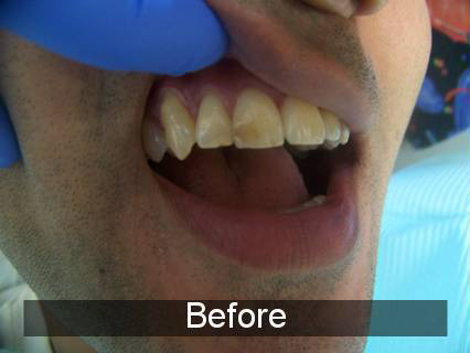 Smiles by Farr | CBCT, E4D and TMJ Disorders