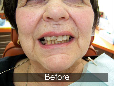 Smiles by Farr | Periodontal Treatment, All-on-4® and Preventative Program