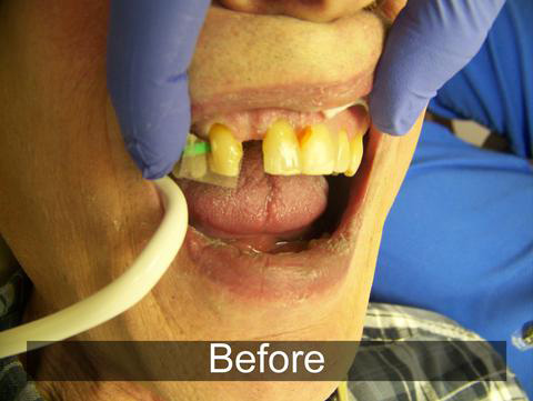 Smiles by Farr | Digital Scanners, Dentures and Periodontal Treatment