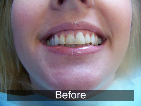 Smiles by Farr | All-on-4®, Root Canals and Digital Scanners