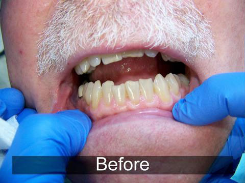 Smiles by Farr | CBCT, Dentures and Extractions