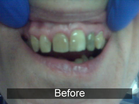 Smiles by Farr | Teeth Whitening, Extractions and E4D