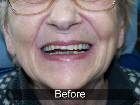 Smiles by Farr | Dental Cleanings, Sports Mouthguards and Digital Radiography