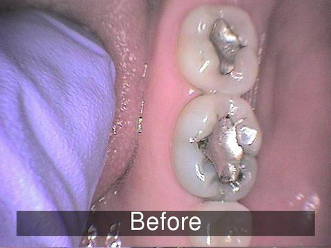 Smiles by Farr | Preventative Program, Oral Cancer Screening and Emergency Treatment