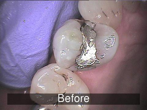 Smiles by Farr | Emergency Treatment, Oral Cancer Screening and Veneers