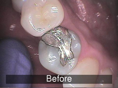 Smiles by Farr | CBCT, Root Canals and Laser Dentistry