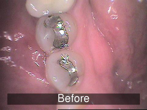 Smiles by Farr | Extractions, Dentures and Pediatric Dentistry