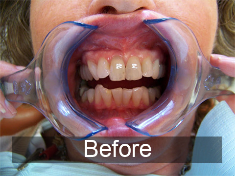 Smiles by Farr | Emergency Treatment, Preventative Program and Dentures