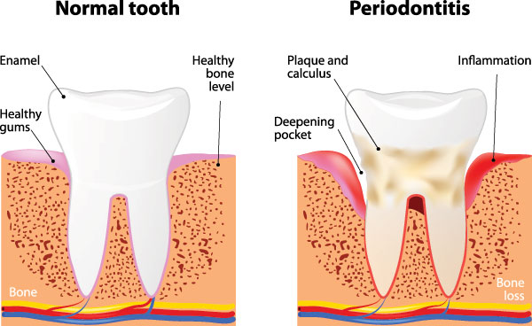 Smiles by Farr | Dental Cleanings, Periodontal Treatment and Ceramic Crowns